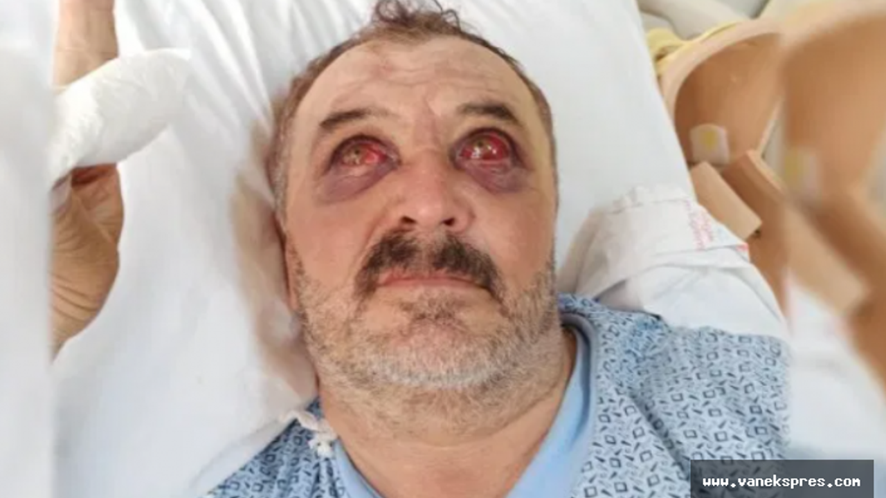 Van'da İşkenceye maruz kalan Şiban taburcu edildi