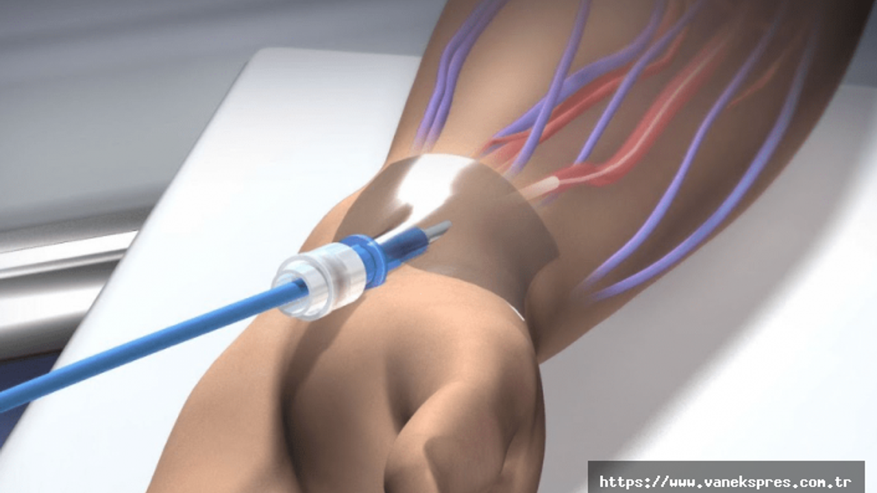 Stent Neden Takılır, Risk Barındırır Mı?