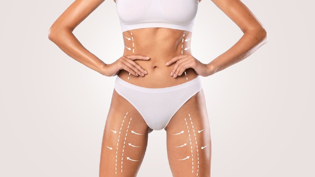 Liposuction ile Formunuzu Yakalayın