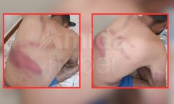 ‘Tefeci’ kabusu: Saatlerce işkence yaptılar
