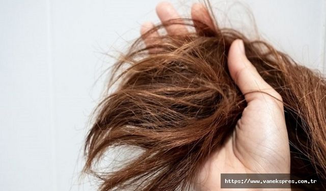 Ankara Saç Dökülmesi Tedavisiyle Saçlarınızı Güçlendirin