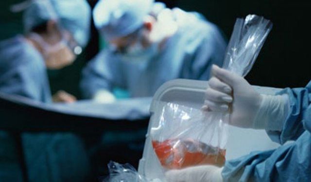 Organ Nakil Ameliyatı Kaç Saat Sürer?