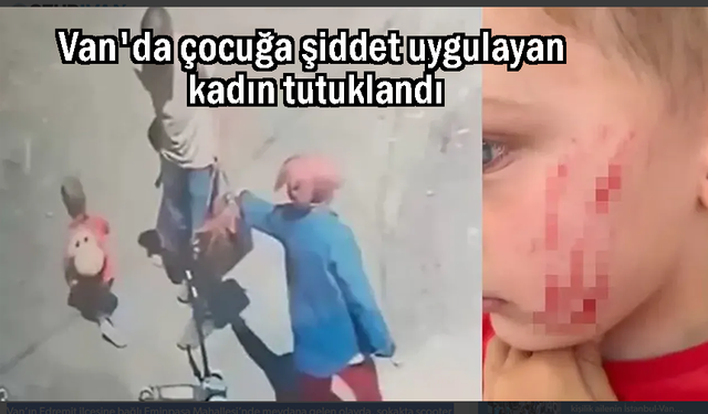 4 yaşındaki çocuğa şiddet uygulayan kadın tutuklandı