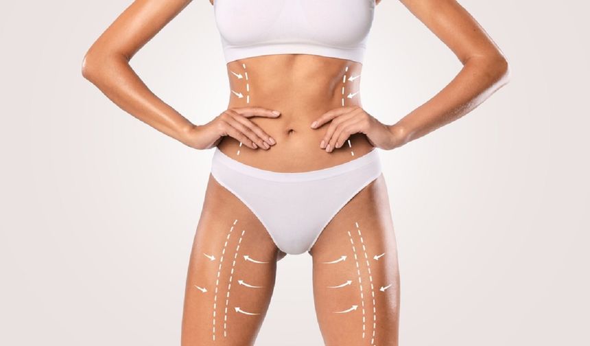 Liposuction ile Formunuzu Yakalayın
