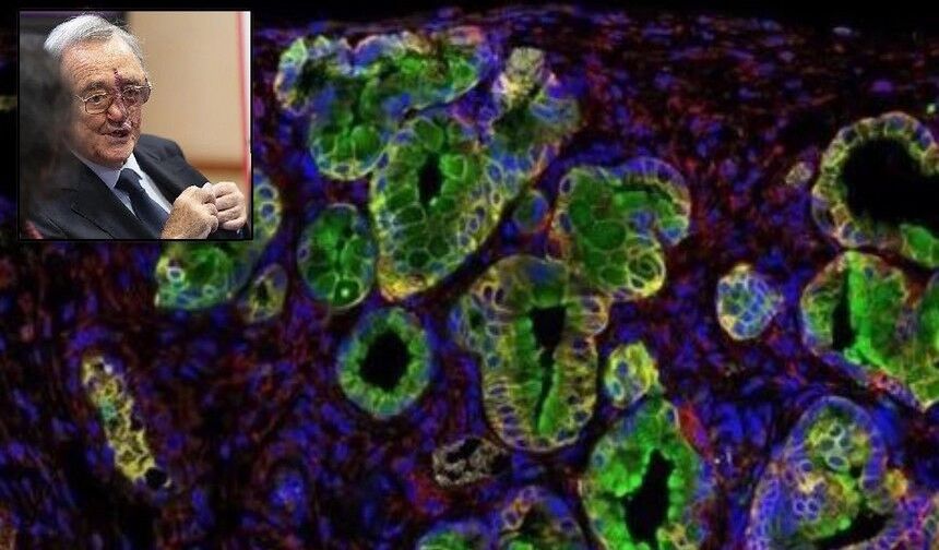 Barbacid: En ölümcül kanser türü ilk kez tamamen yok edildi