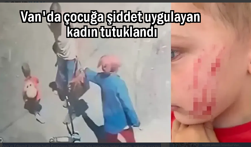4 yaşındaki çocuğa şiddet uygulayan kadın tutuklandı